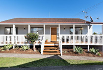 Renovation in Highland Park by Auckland Building Specialists Ltd